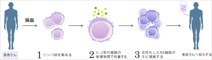 NK細胞療法(非特異的治療)