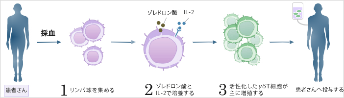 ガンマ・デルタT細胞療法(γδT細胞療法)(非特異的治療)