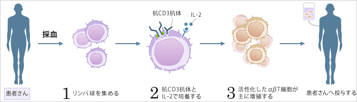 アルファ・ベータT細胞療法(αβT細胞療法)(非特異的治療)